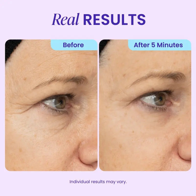 NEW! AQA Instant Lift Eye Gel - For the look of Puffiness & Bags, Wrinkles, Fine Lines and Dark Circles, Anti Aging Skin Care for Men & Women with Collagen Targeting Biotech Under Eye Brightener