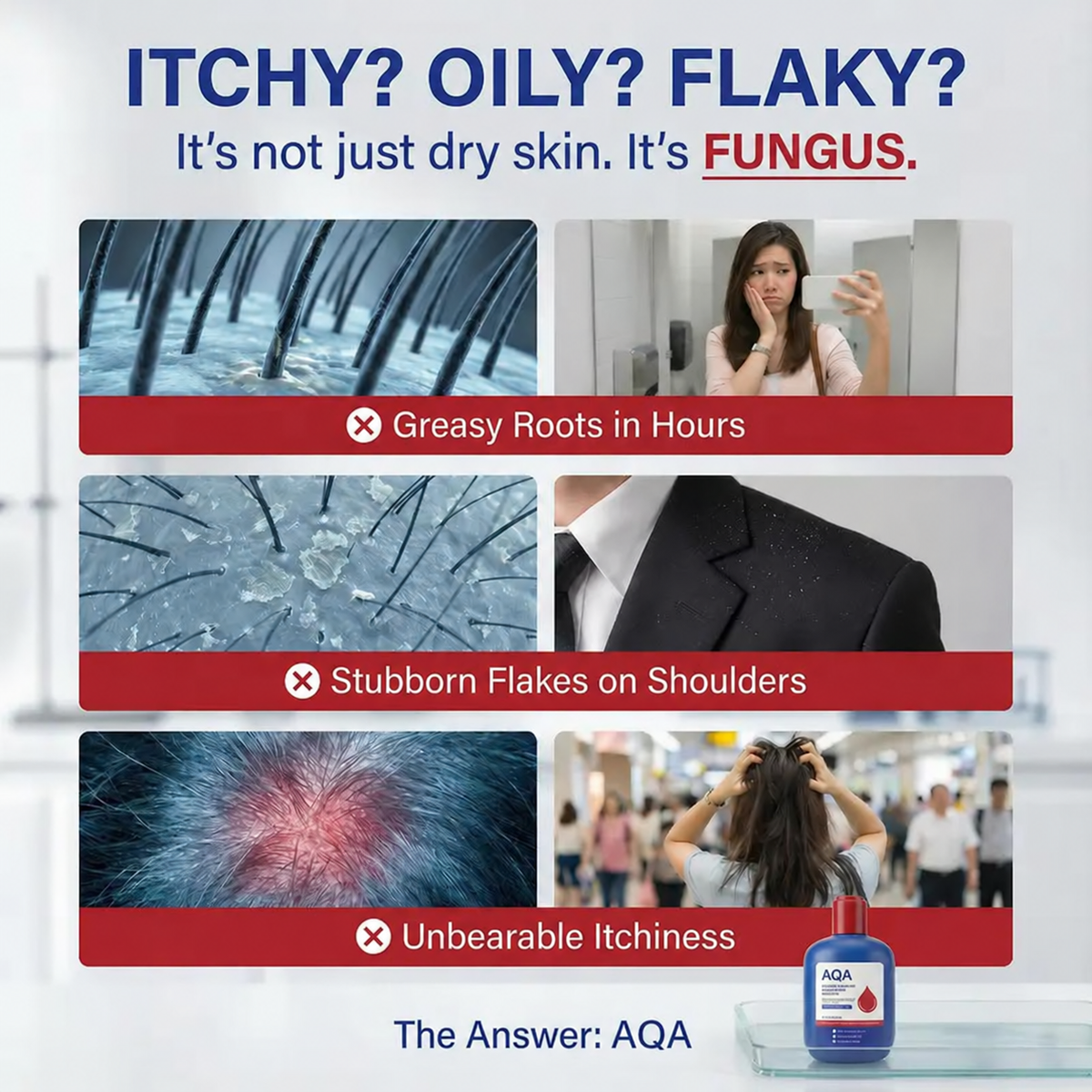 Oily itchy flaky scalp care