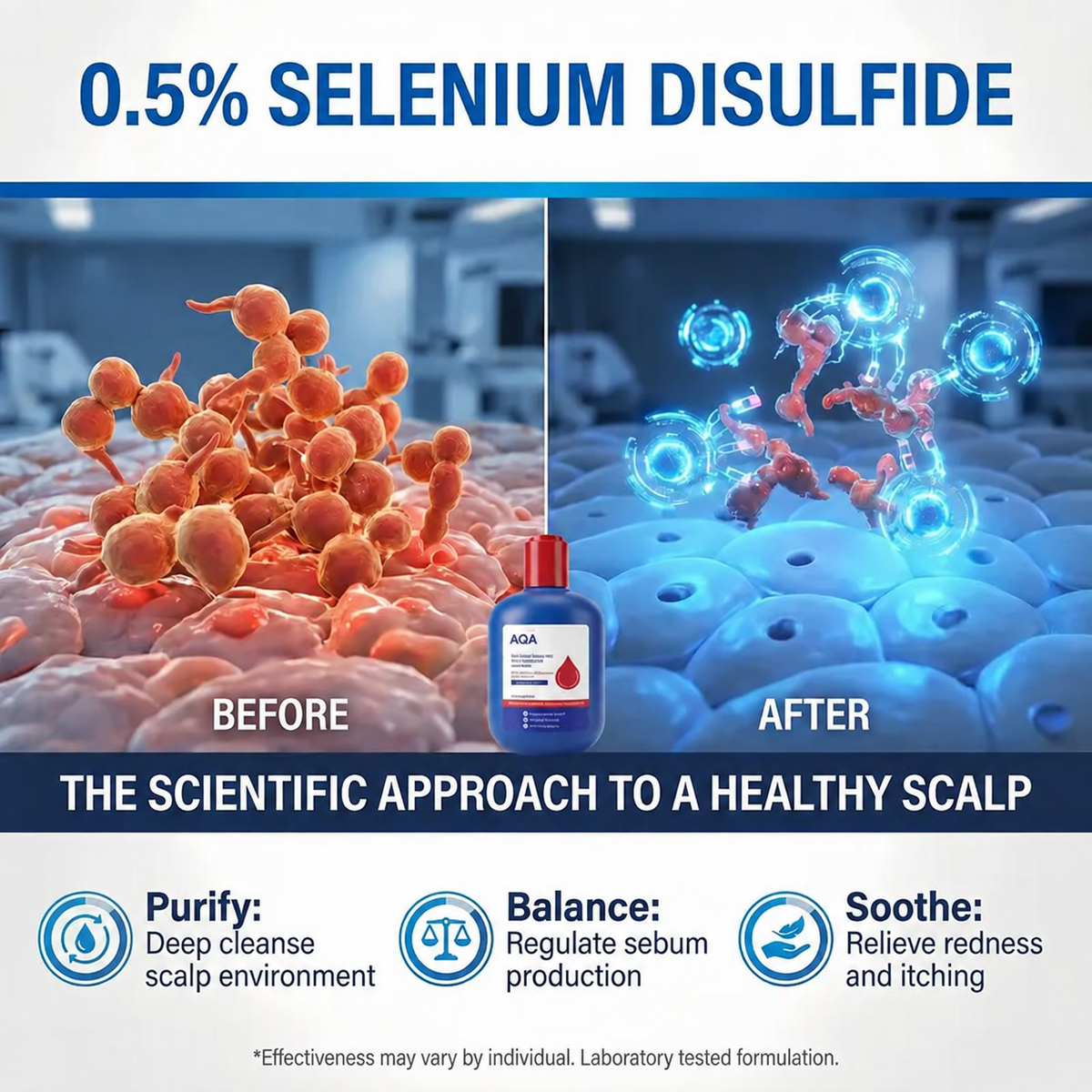Selenium Sulfide Anti-Dandruff Shampoo 300ML – Anti-Itch, Oil Control & Scalp Care