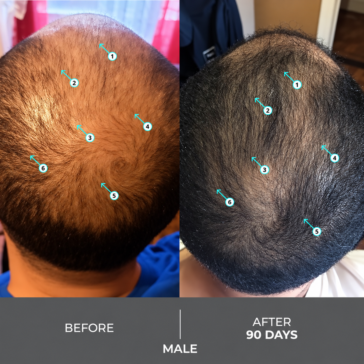 Extra Strength Hair DENSITY Shampoo