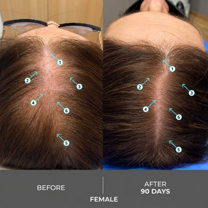 Extra Strength Hair DENSITY Shampoo